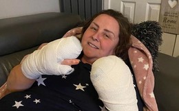 Người phụ nữ mất 8 ngón tay vì căn bệnh bí ẩn