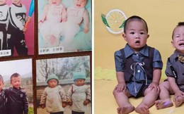Ngôi làng song sinh kỳ lạ: 10 năm có 33 cặp sinh đôi, người nhà cũng khó phân biệt được