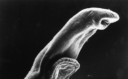 Những loài ký sinh trùng nguy hiểm nhất ở người từng được phát hiện