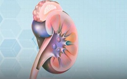 Tiến bộ trong lĩnh vực ghép thận tại Anh