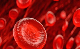 Nghiên cứu mới: Người có nhóm máu này có nguy cơ đột quỵ trước 60 tuổi cao hơn