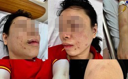 Vụ người phụ nữ ở Hà Nội tố bị ‘bắt cóc’, đánh đập dã man: Chồng cũ khai nhận hành vi