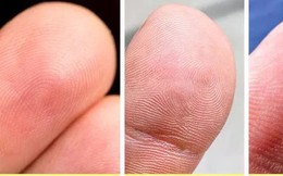12 đặc điểm cơ thể tưởng bình thường nhưng lại là của hiếm