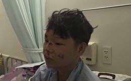 Lời kể của tài phụ vụ lật xe chở dưa ở Phú Yên khiến 9 người thương vong