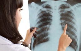 Nữ giáo viên sốc khi phát hiện mắc ung thư phổi, chia sẻ 3 dấu hiệu đã trải qua
