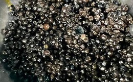 Đau bụng đi khám, người phụ nữ có hàng nghìn viên sỏi mật: Dấu hiệu cảnh báo là gì?