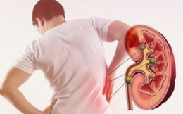 Suy thận ở thanh thiếu niên và dấu hiệu cảnh báo sớm