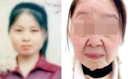 Trung Quốc: Bệnh lạ sau khi sinh con bỗng trở thành bà già