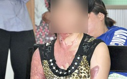 Xin tiền không được, thiêu sống 'vợ hờ'