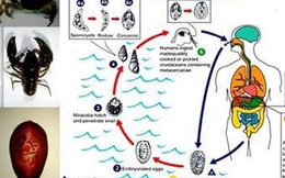 Tiêu chảy, ho ra máu vì sán lá phổi trong tôm, cua nước ngọt