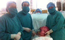 Cắt khối u xơ khổng lồ nặng gần 10kg