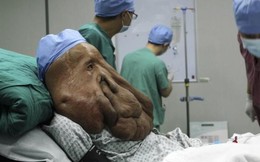 Người mặt voi Trung Quốc trải qua ca phẫu thuật lần ba