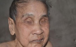 Cuộc sống cùng cực của cụ bà 82 tuổi mù hai mắt, nằm liệt giường