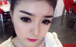 Hot girl Lily Luta viêm mắt nặng vì đeo lens