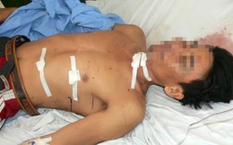 Cầm kéo đâm chết người yêu vì không chịu mở cửa