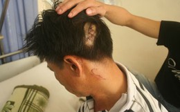 Đến nhà mẹ vợ, bị đánh phải nhập viện