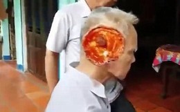 Xuất hiện video mới về người đàn ông bị virus lạ ăn nát mặt