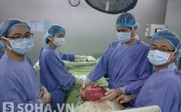 Khối u khổng lồ trong bụng nữ bệnh nhân vừa được lấy ra