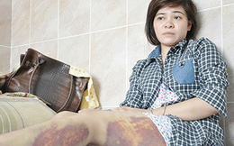 Tây Ninh: Kỷ luật Trung tá công an đánh dã man nữ công nhân