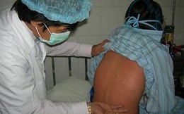 Xuất hiện ổ dịch rubella tại Bình Dương: 138 ca nghi nhiễm