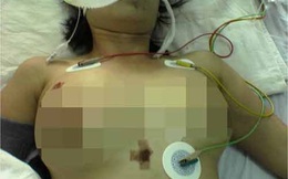 Cô gái bị nhiễm trùng hai bầu ngực vì bơm silicon lỏng
