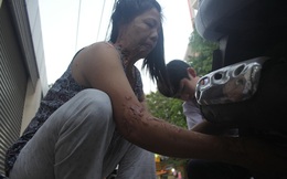 Người lạ mặt đến đặt vấn đề "rút lại đơn" với chị vá xe bị tạt axit ở Sài Gòn