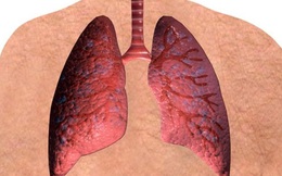 Vitamin B giúp giảm nguy cơ mắc ung thư phổi lên đến 50%