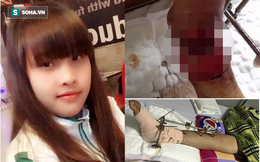Con gái bị tai nạn có nguy cơ phải cắt cụt chân, cha nghèo cắm sổ đỏ vay tiền chữa trị