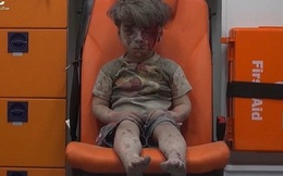 Anh trai của cậu bé người Syria đã tử vong vì thương tích quá nặng