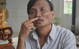 Bất đồng chuyện uống bia, Bí thư xã đánh bầm dập cán bộ