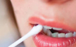 3 cách cực đơn giản chữa chảy máu chân răng tức thì mà bạn nên áp dụng
