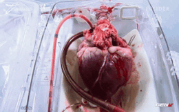 [Video] Làm sao để giữ cho quả tim tiếp tục đập ngay cả khi được lấy ra khỏi cơ thể người