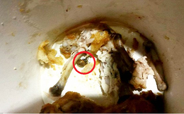 Gà rán KFC "tẩm ướp gia vị lạ" khiến thai phụ ở tháng thứ 7 ngộ độc suốt ba ngày