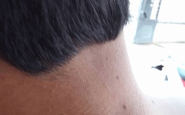 Làm rõ vụ cự cãi việc thu tiền cước, phụ xe đánh 2 hành khách bị thương