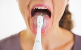 Quên chải lưỡi khi đánh răng gây ra 4 bệnh nguy hiểm: Đây là cách làm sạch lưỡi hàng ngày
