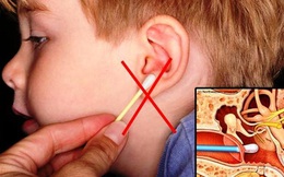 Nhỏ 1 giọt oxy già vào tai trước khi tắm: Cách lấy ráy tai an toàn không phải ai cũng biết