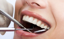 14 sai lầm vô tình phá hỏng sức khỏe hàm răng của bạn