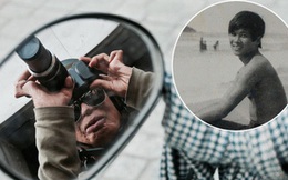 Chuyện của nhiếp ảnh gia 60 tuổi ở Sài Gòn được tái sinh sau 17 ca phẫu thuật vì bỏng lửa