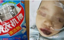 Người lớn bất cẩn, cô bé 2 tuổi bị "cháy miệng" vì nhầm tưởng chất tẩy rửa siêu mạnh là sữa bột