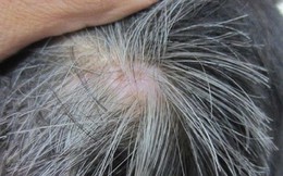 Ai nói già mới bị tóc bạc, bây giờ trẻ tóc đã bạc trắng nhiều rồi ấy chứ? Vì sao nhỉ?