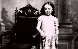 Cuộc sống địa ngục của Mary Ellen Wilson, nạn nhân đầu tiên từng được ghi nhận của nạn bạo hành trẻ em đã khiến luật pháp Mỹ phải thay đổi