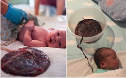 Những nguy cơ cho trẻ khi mẹ muốn theo trào lưu "thuận tự nhiên", không cắt rốn