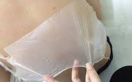 Bác sĩ da liễu lý giải nguy cơ ung thư da do tắm trắng