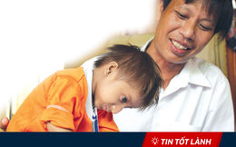 TIN TỐT LÀNH 02/04: Cậu bé tí hon 10 tuổi 3,9kg - Cô hàng cơm giá nào cũng bán & Cô hàng thịt lợn mắc mùng bán hàng