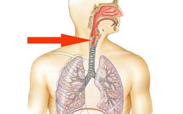 Khi thấy khó nuốt và các triệu chứng này, hãy cảnh giác với căn bệnh ung thư thực quản