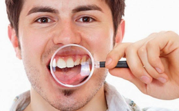 Những biện pháp khắc phục cơn đau răng tại nhà: Đơn giản nhưng hiệu quả, rẻ tiền