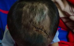 Bình Dương: Nghi vấn cháu bé 3 tuổi bị mẹ ruột và "cha hờ" bạo hành dã man