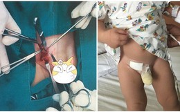 Thấy con có khối u nhỏ ở háng nhưng mẹ không bận tâm, đưa con đi khám nghe bác sĩ nói mẹ mới hốt hoảng