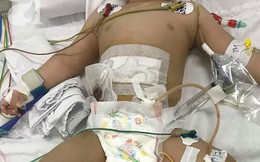 TP.HCM: Bé trai 11 tháng tuổi bị mẹ ruột dùng dao đâm nhiều nhát vào bụng nguy kịch