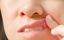 Một số vấn đề sức khỏe răng miệng không phải ai cũng biết